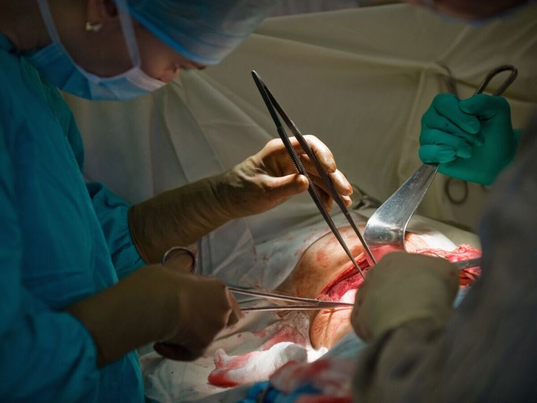 ������ �����: ������� ���������������� ��� ��������� �������?